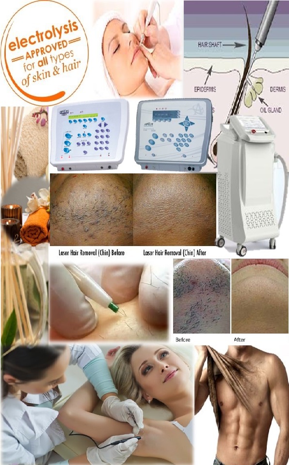 electrolysis.jpg